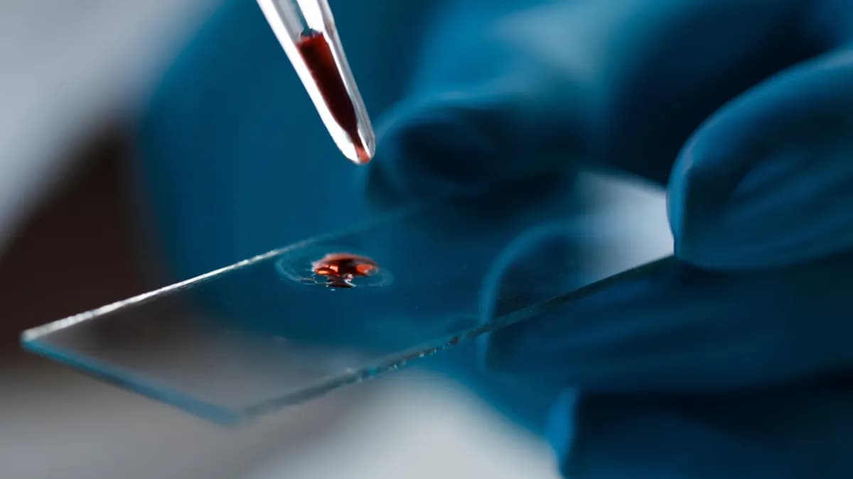 Un nuevo péptido podría ser clave en la lucha contra el Alzheimer