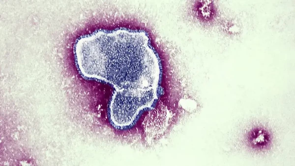 Mutaciones del VRS y su impacto en la bronquiolitis infantil