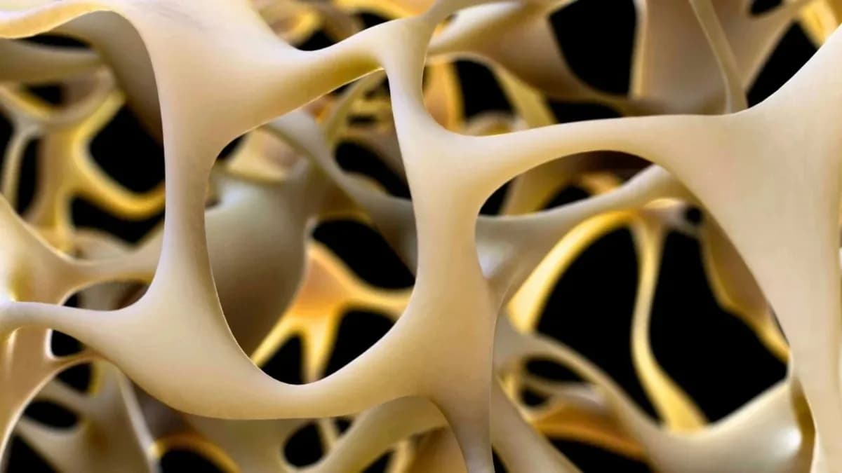La hipertensión podría acelerar la osteoartritis